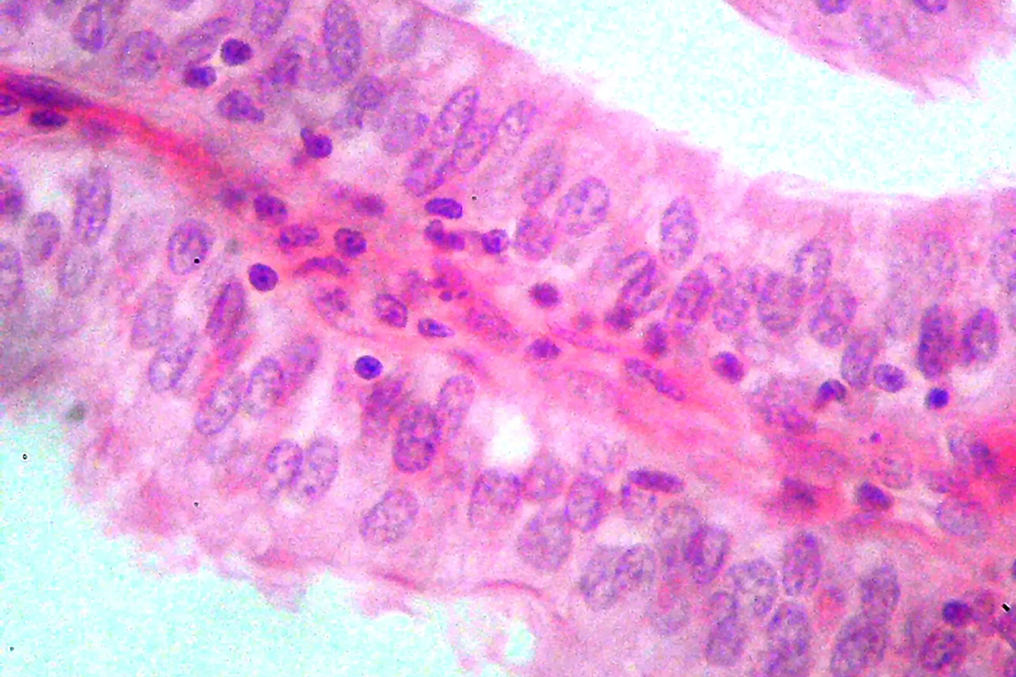 Patología Ginecológica