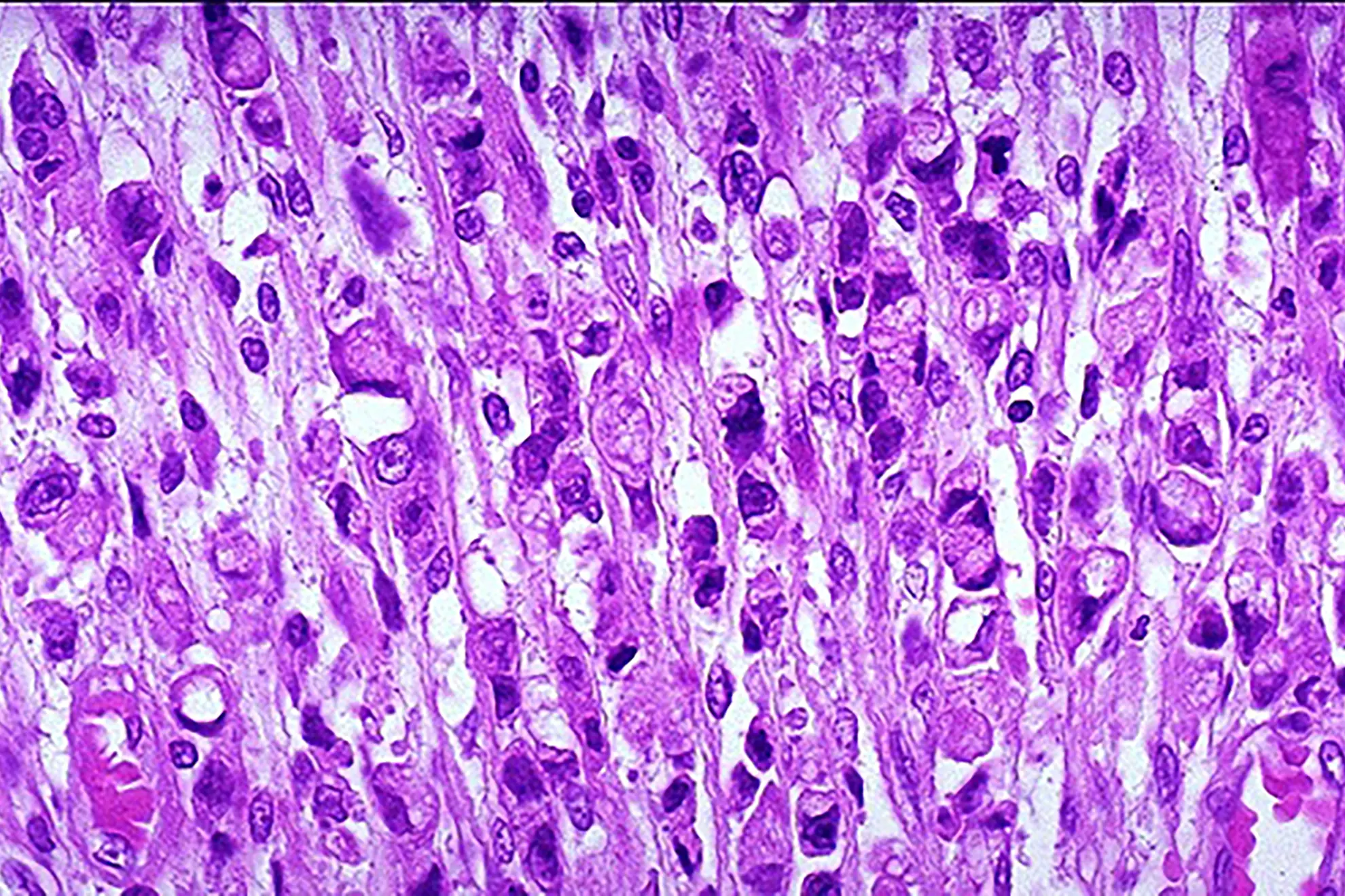 Patología Gastrointestinal