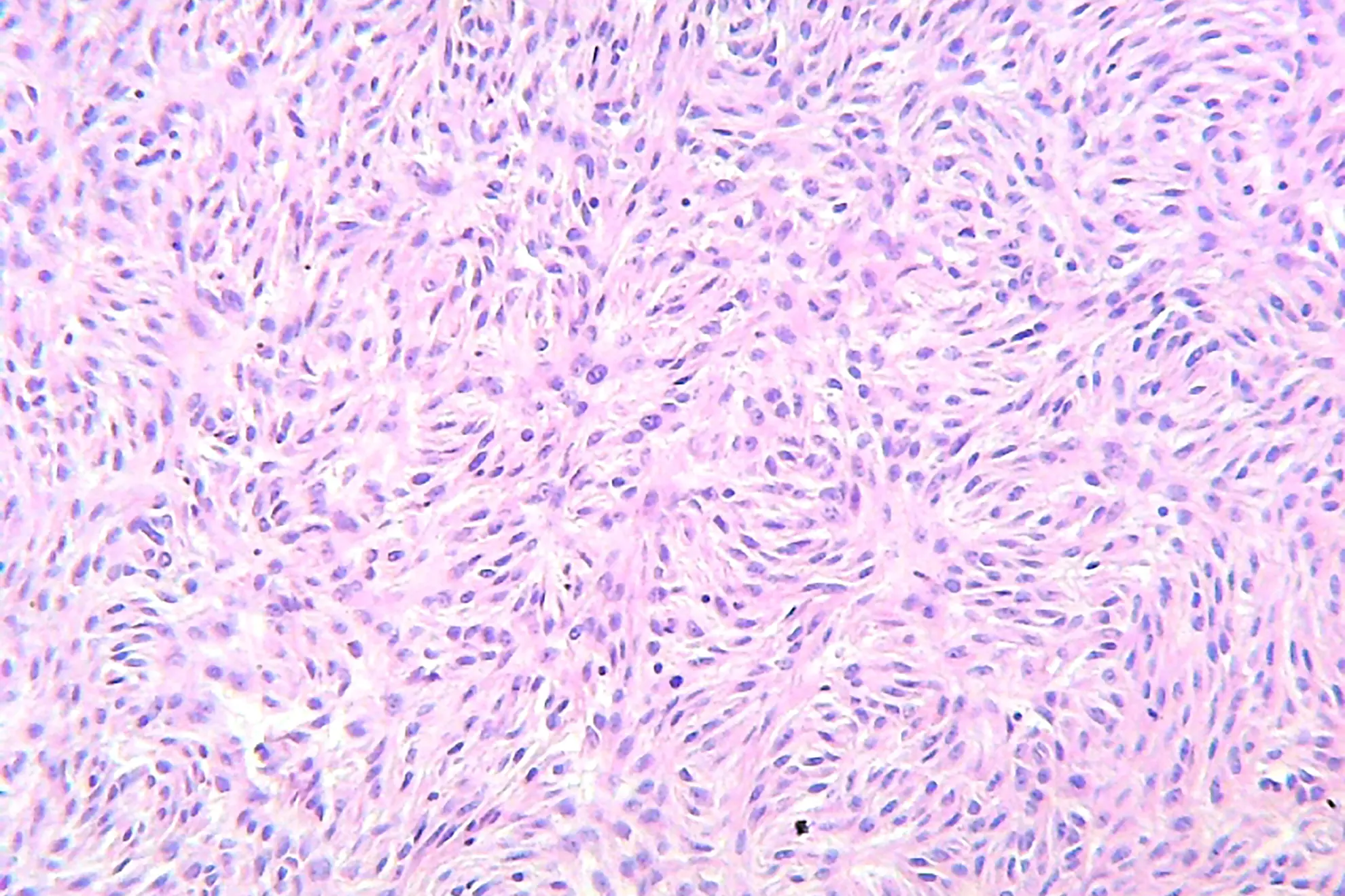 Patología de Cabeza y Cuello