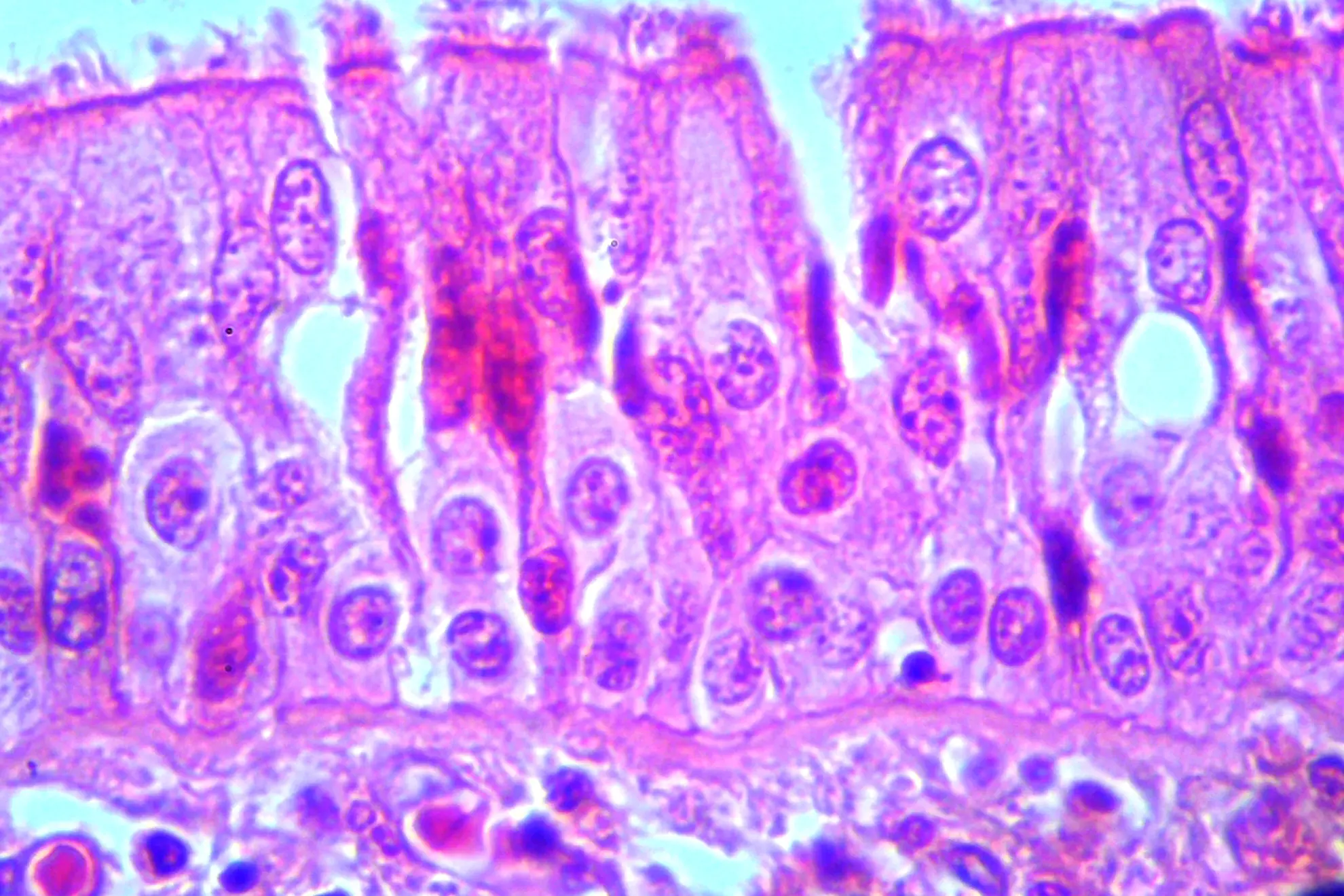 Pruebas rápidas y serología